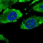 Immunofluorescent staining of human cell line PC-3 shows localization to nucleoli & cytosol.