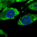 Anti-PTTG1 Antibody