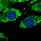 Immunofluorescent staining of human cell line PC-3 shows localization to nucleoli & cytosol.