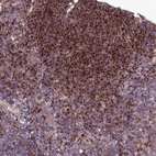 Immunohistochemical staining of human tonsil shows strong granular cytoplasmic positivity in non-germinal center cells.