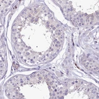 Immunohistochemical staining of human testis shows no positivity in cells in seminiferous ducts as expected.