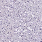 Immunohistochemical staining of human liver shows no positivity in hepatocytes as expected.