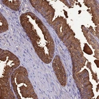 Anti-OR56B1 Antibody