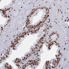 Anti-PCDHB11 Antibody