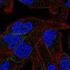 Immunofluorescent staining of human cell line RH-30 shows localization to plasma membrane.