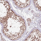 Anti-NBPF4 Antibody