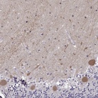 Anti-EIF4E1B Antibody