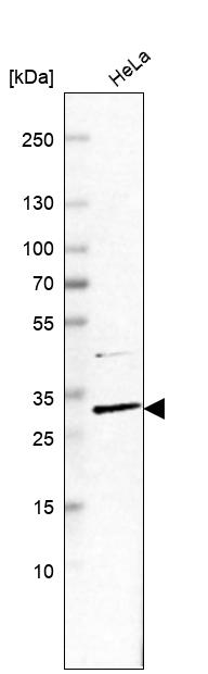 Anti-CCDC127 Antibody