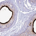 Immunohistochemical staining of human epididymis shows high expression.
