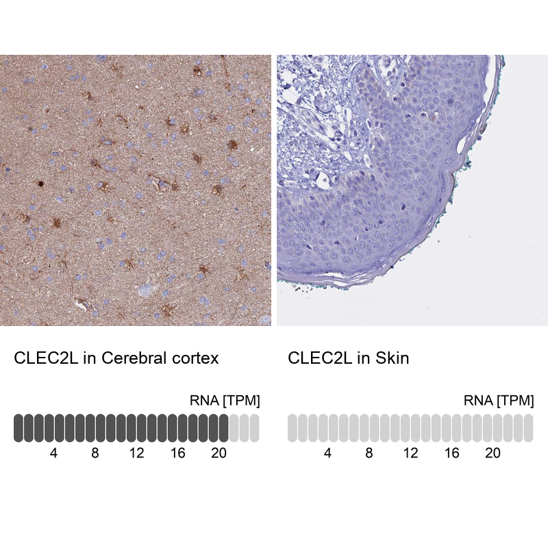 Anti-CLEC2L Antibody