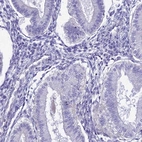 Immunohistochemical staining of human endometrium shows low expression as expected.