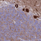 Immunohistochemical staining of human cerebellum shows strong cytoplasmic positivity in Purkinje cells.