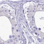 Immunohistochemical staining of human testis using Anti-SMIM24 antibody HPA045046.