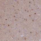 Immunohistochemical staining of human cerebral cortex shows strong cytoplasmic positivity in glial cells and neuropil.