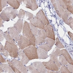 Immunohistochemical staining of human skeletal muscle shows moderate cytoplasmic positivity in myocytes.