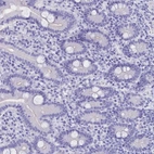 Immunohistochemical staining of human duodenum shows negative cytoplasmic positivity in glandular cells as expected.