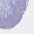 Immunohistochemical staining of human skin shows negative cytoplasmic positivity in squamous epithelial cells as expected.