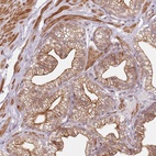 Anti-RPS6KA2 Antibody