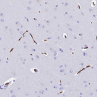 Immunohistochemical staining of human cerebral cortex shows strong membranous positivity in endothelial cells.