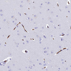 Anti-NINJ1 Antibody