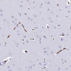 Immunohistochemical staining of human cerebral cortex shows strong membranous positivity in endothelial cells.