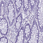 Anti-NINJ1 Antibody