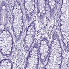 Immunohistochemical staining of human rectum shows no positivity in glandular cells as expected.