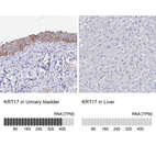 Anti-KRT17 Antibody