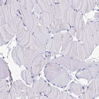 Anti-NINJ1 Antibody