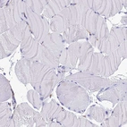 Immunohistochemical staining of human skeletal muscle shows no positivity in myocytes as expected.