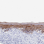 Immunohistochemical staining of human skin shows strong membranous positivity in epidermal cells.