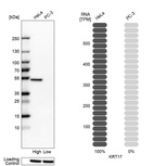 Western blot analysis in human cell lines HeLa and PC-3 using Anti-KRT17 antibody. Corresponding KRT17 RNA-seq data are presented for the same cell lines. Loading control: Anti-HSP90B1.