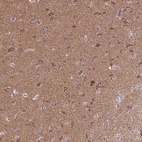 Anti-MAPK11 Antibody