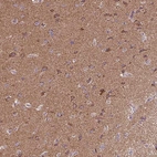 Anti-MAPK11 Antibody