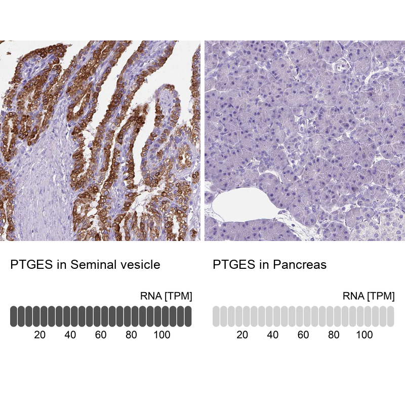 Anti-PTGES Antibody