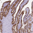 Immunohistochemical staining of human seminal vesicle shows strong membranous and cytoplasmic positivity in glandular cells.