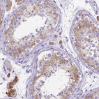 Immunohistochemical staining of human testis shows weak to moderate membranous and cytoplasmic positivity in cells in seminiferous ducts.