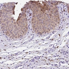Immunohistochemical staining of human urinary bladder shows moderate cytoplasmic positivity in urothelial cells.