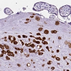 Immunohistochemical staining of human placenta shows strong cytoplasmic positivity in decidual cells.