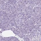 Immunohistochemical staining of human pancreas shows no positivity in exocrine glandular cells as expected.