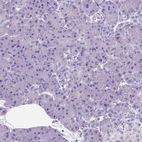 Immunohistochemical staining of human pancreas shows no positivity in exocrine glandular cells as expected.