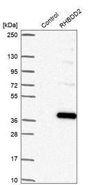 Anti-RHBDD2 Antibody