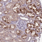 Anti-CEACAM16 Antibody