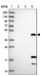 Lane 1: Marker [kDa] 250, 130, 95, 72, 55, 36, 28, 17, 10_br/_Lane 2: Human cell line RT-4_br/_Lane 3: Human cell line U-251MG sp_br/_Lane 4: Human plasma (IgG/HSA depleted)
