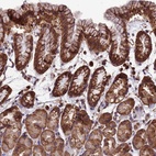 Anti-LSM6 Antibody