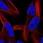 Anti-LRRC37A2 Antibody