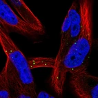 Immunofluorescent staining of human cell line RH-30 shows localization to vesicles.