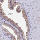 Immunohistochemical staining of human prostate shows moderate granular cytoplasmic positivity in glandular cells.