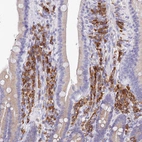 Immunohistochemical staining of human duodenum shows strong cytoplasmic positivity in lymphoid cells.