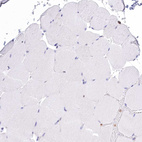 Immunohistochemical staining of human skeletal muscle shows no positivity in myocytes as expected.